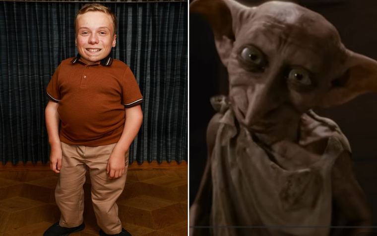 HBO Harry Potter casts BBC star as Dobby as actor beams 'over the moon to be joining the magical world'