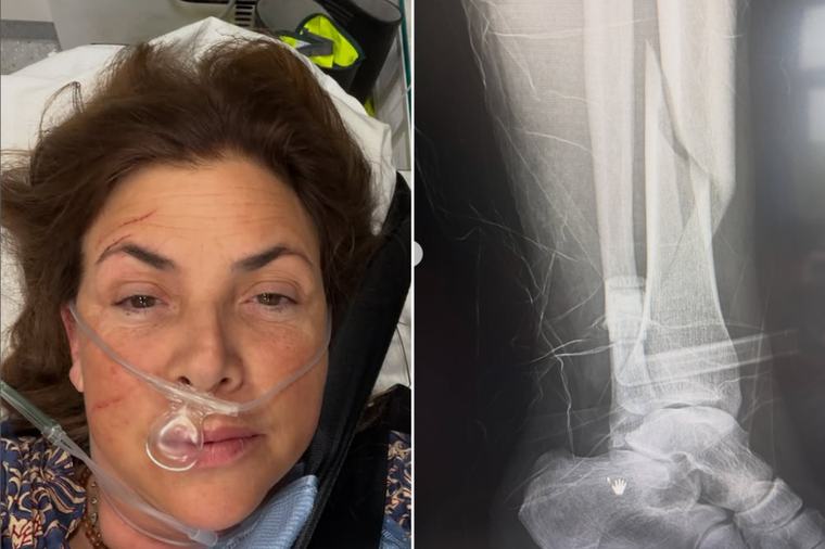 Kirstie Allsopp rushed to hospital by air ambulance and undergoes surgery after horror birthday fall
